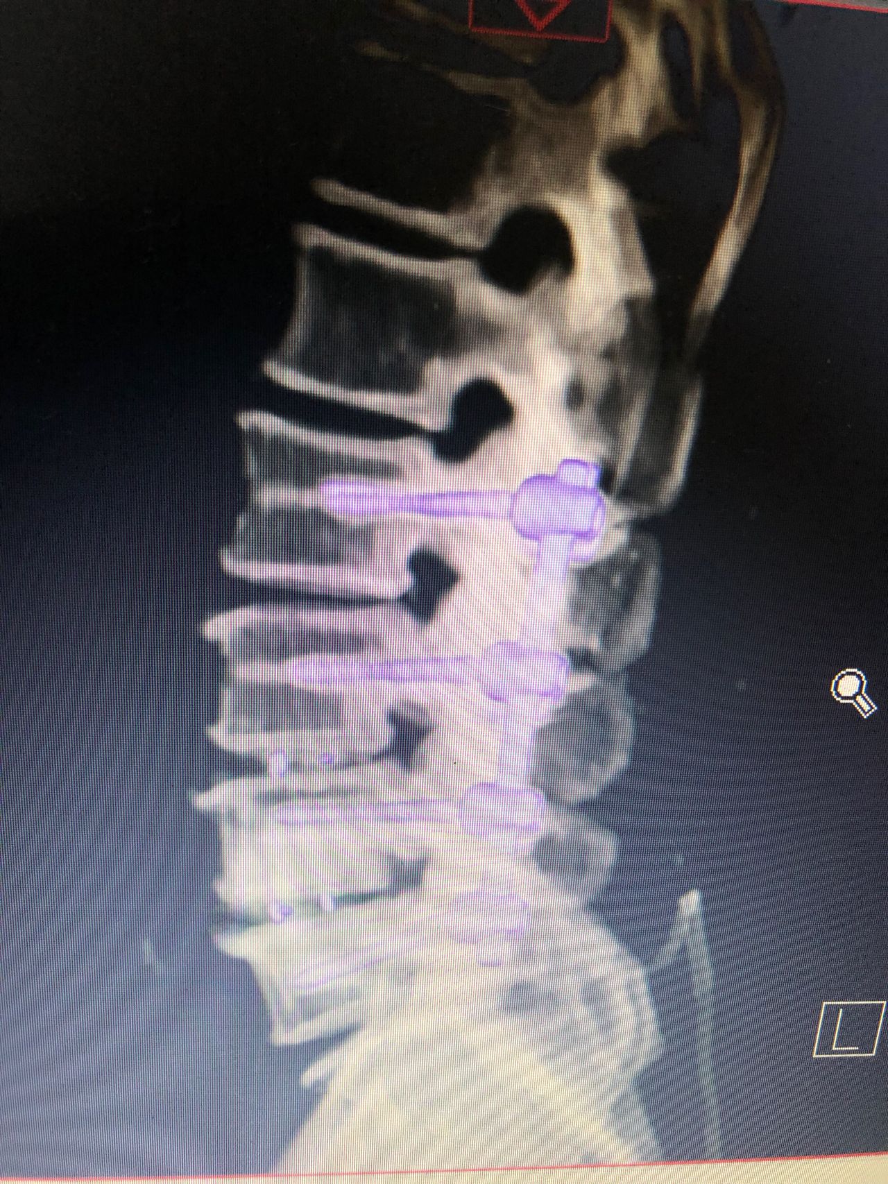 José Lopes Sousa Filho-35