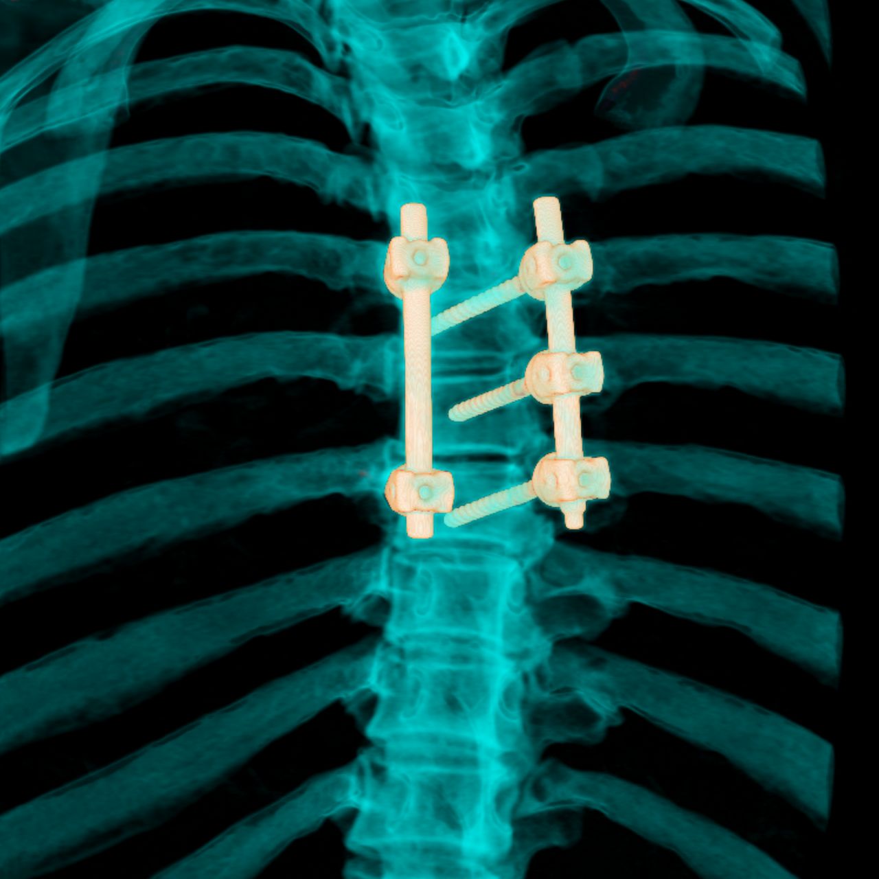 David Tafur Muñoz-1463