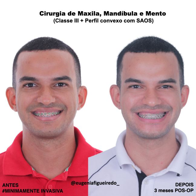 Eugênia Figueiredo-25