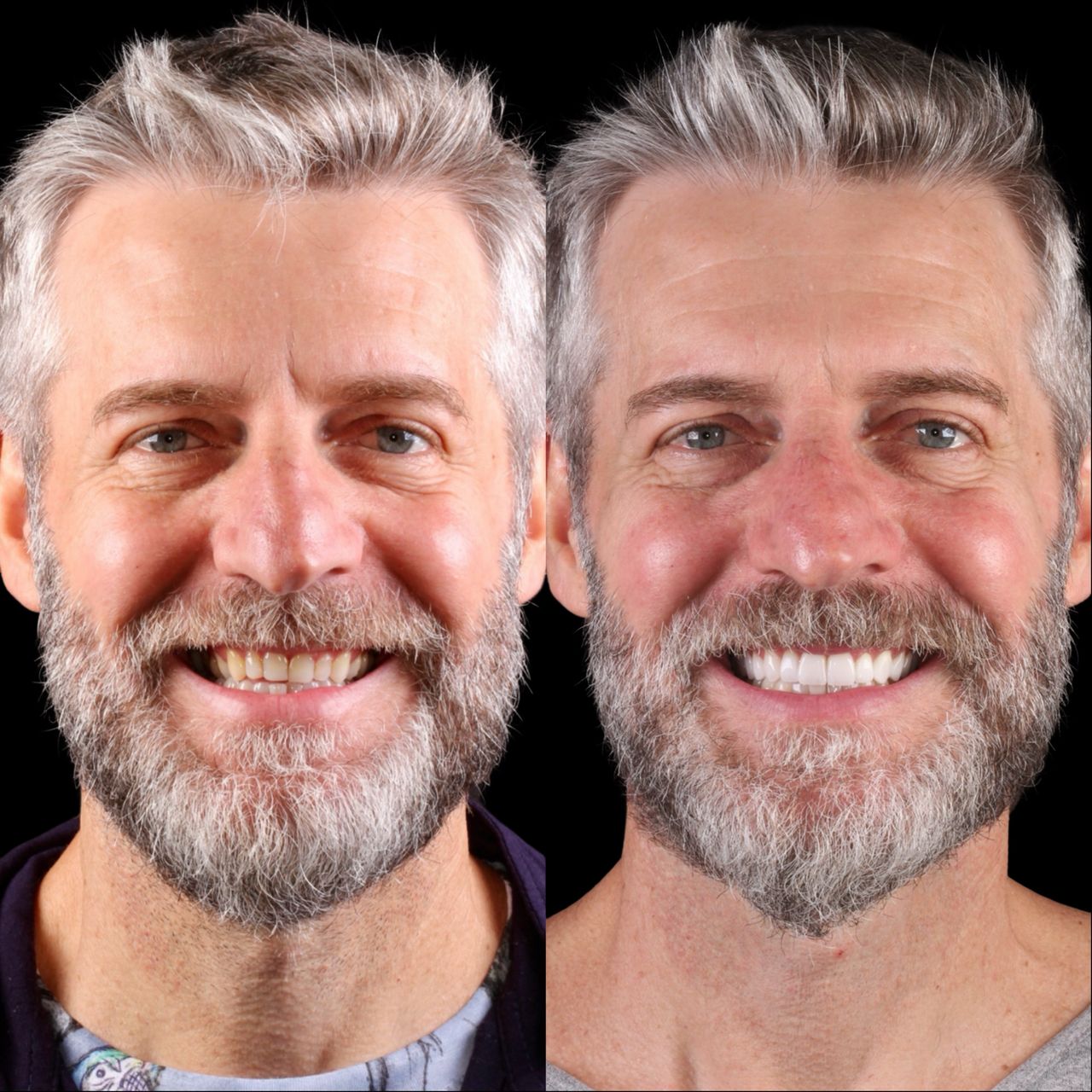 Caroline Benedeti-28