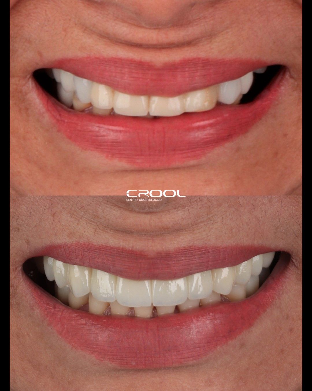 Frederico  Coelho-19