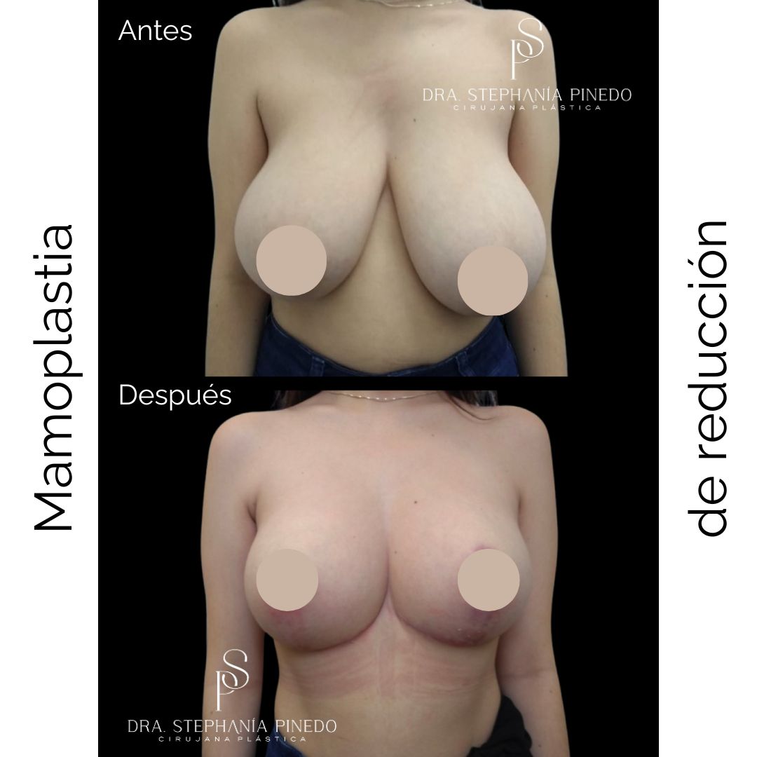 Stephanía Pinedo García-6