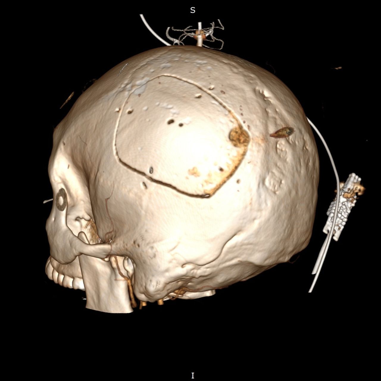 David Tafur Muñoz-1284