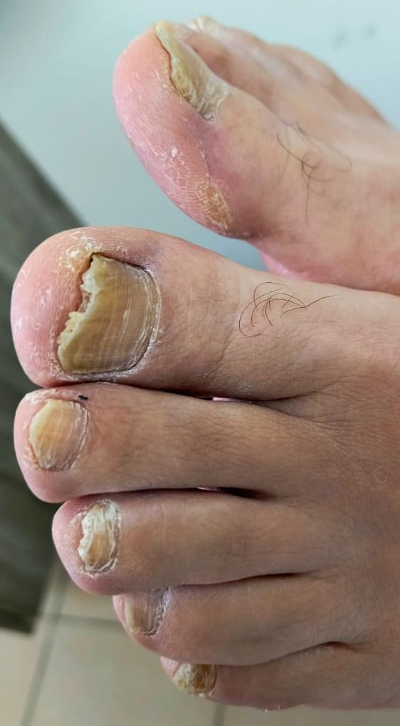 Marcos Ortiz Perez-7