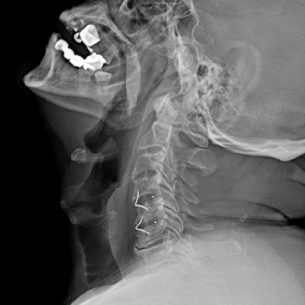 David Tafur Muñoz-1624