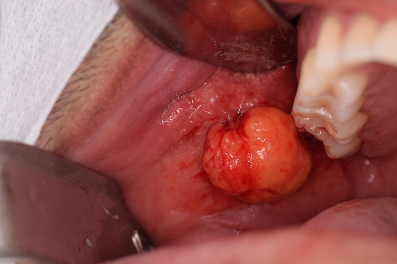 Ana Paula Simões-16