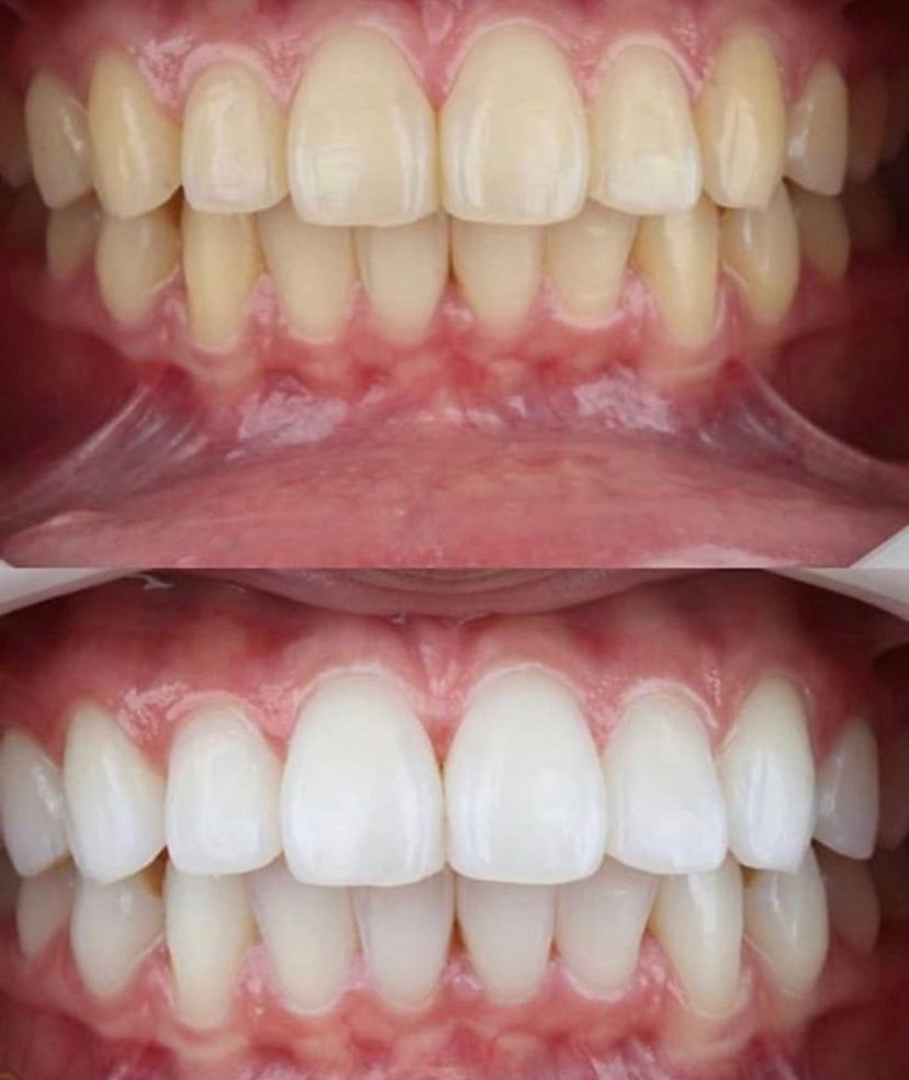 Leandro Ponte Dias-33