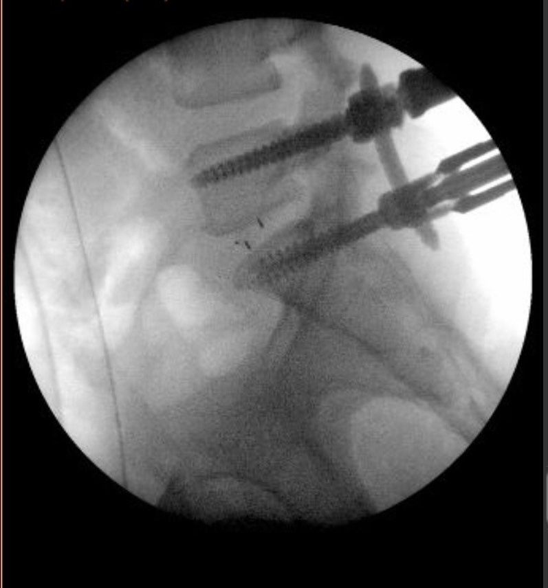 Fabricio Zacarias Paes-2