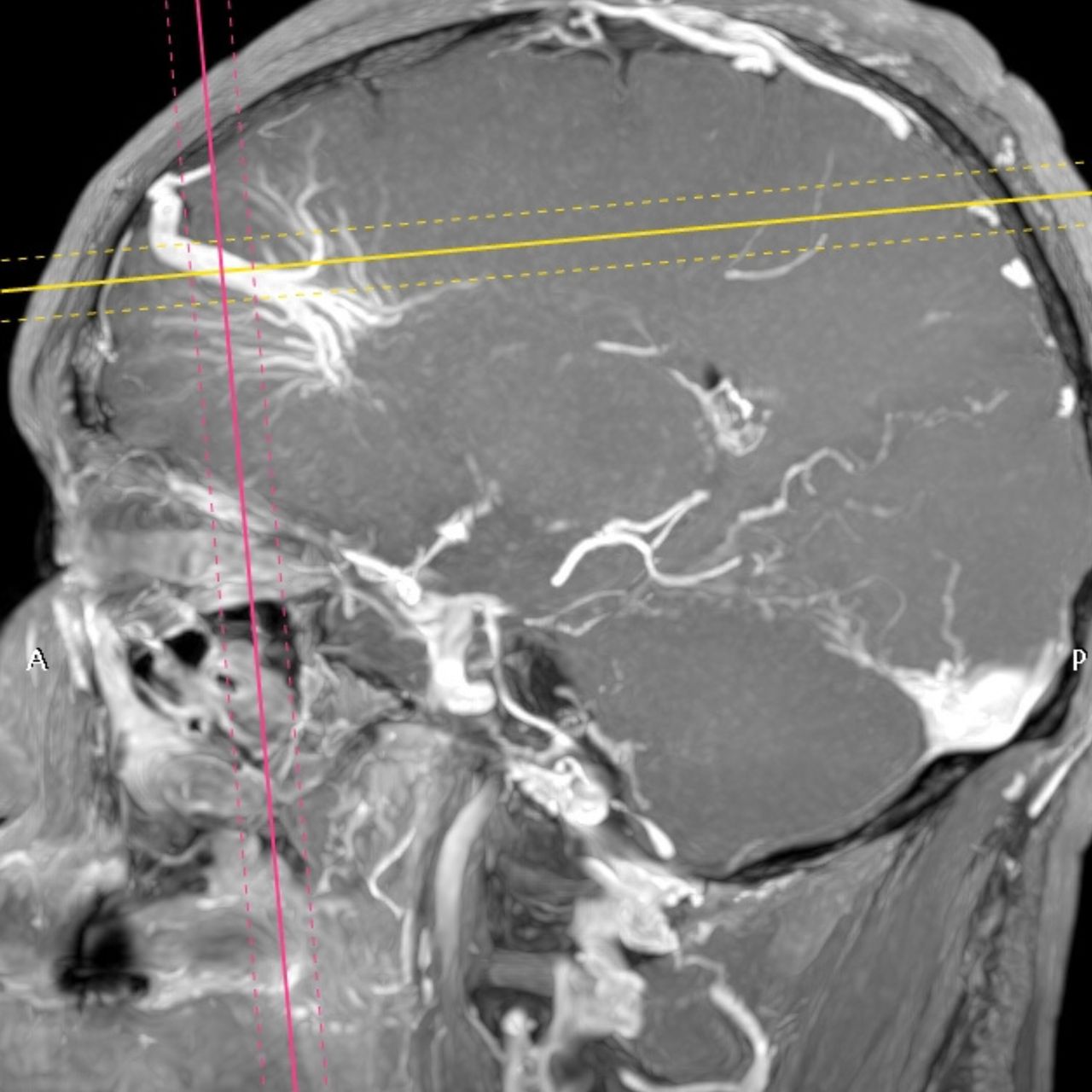 David Tafur Muñoz-1282