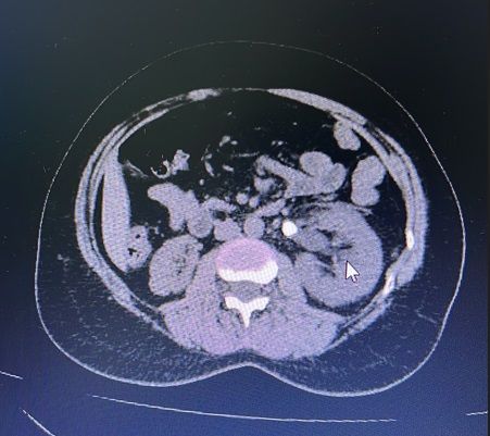 Guilherme Napoleão Lira-2