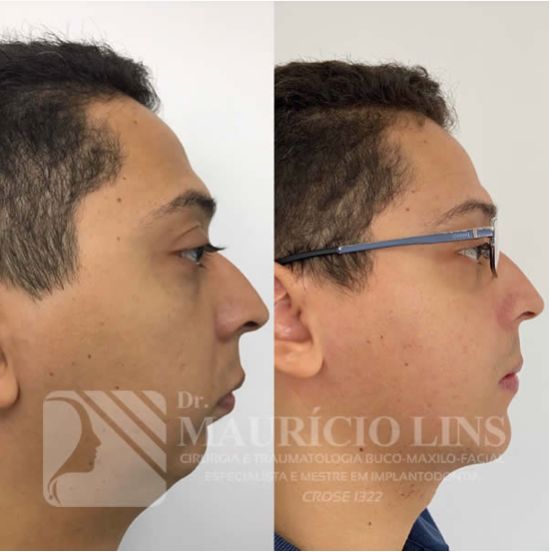 Mauricio Lins Moura-18