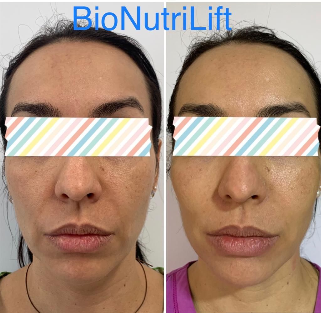 Maria Gisela Angel Losada-82