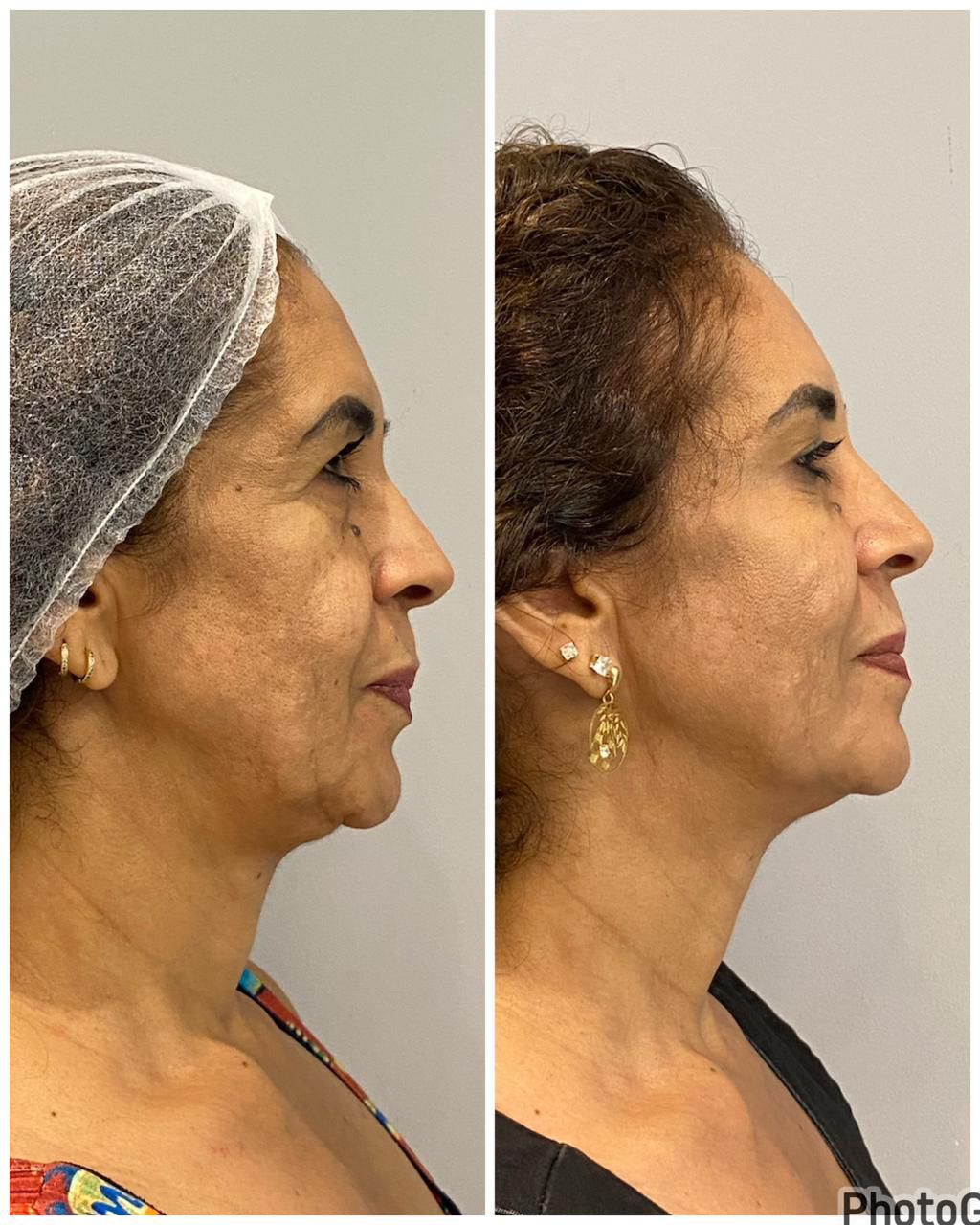 Larissa Abreu-20