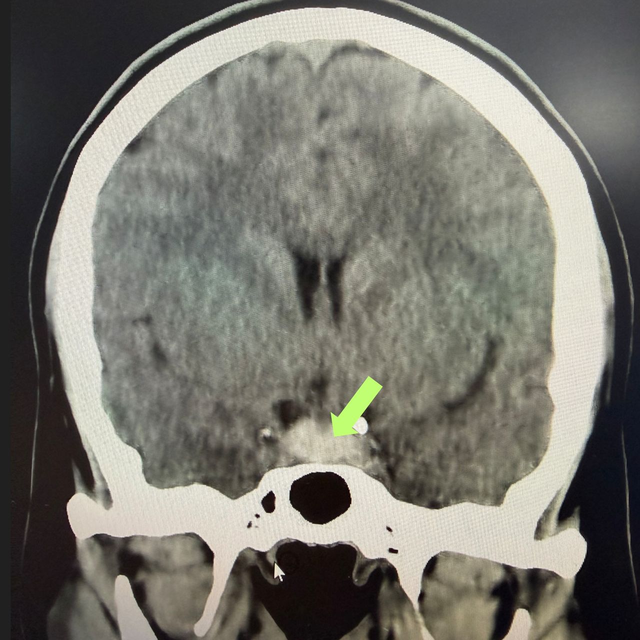 David Tafur Muñoz-2374