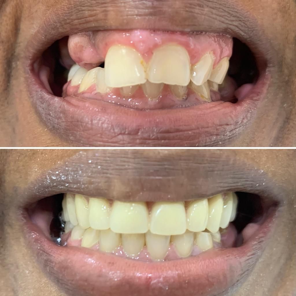 Fernanda Archipéva-16