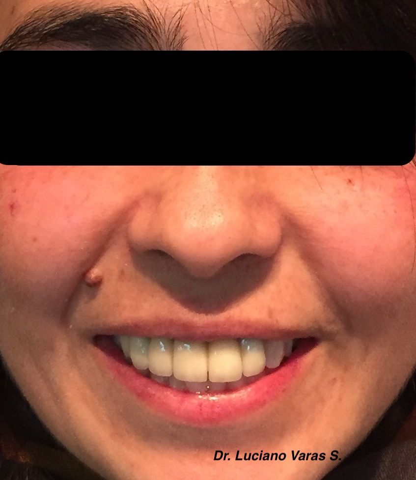 Luciano Varas Salinas-23