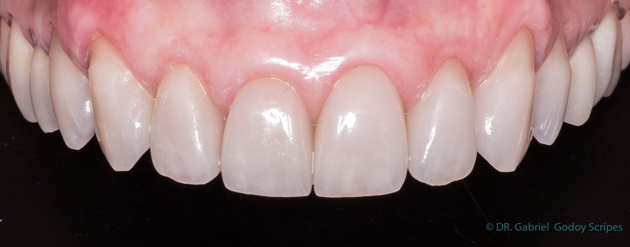 Gabriel Godoy Scripes-81