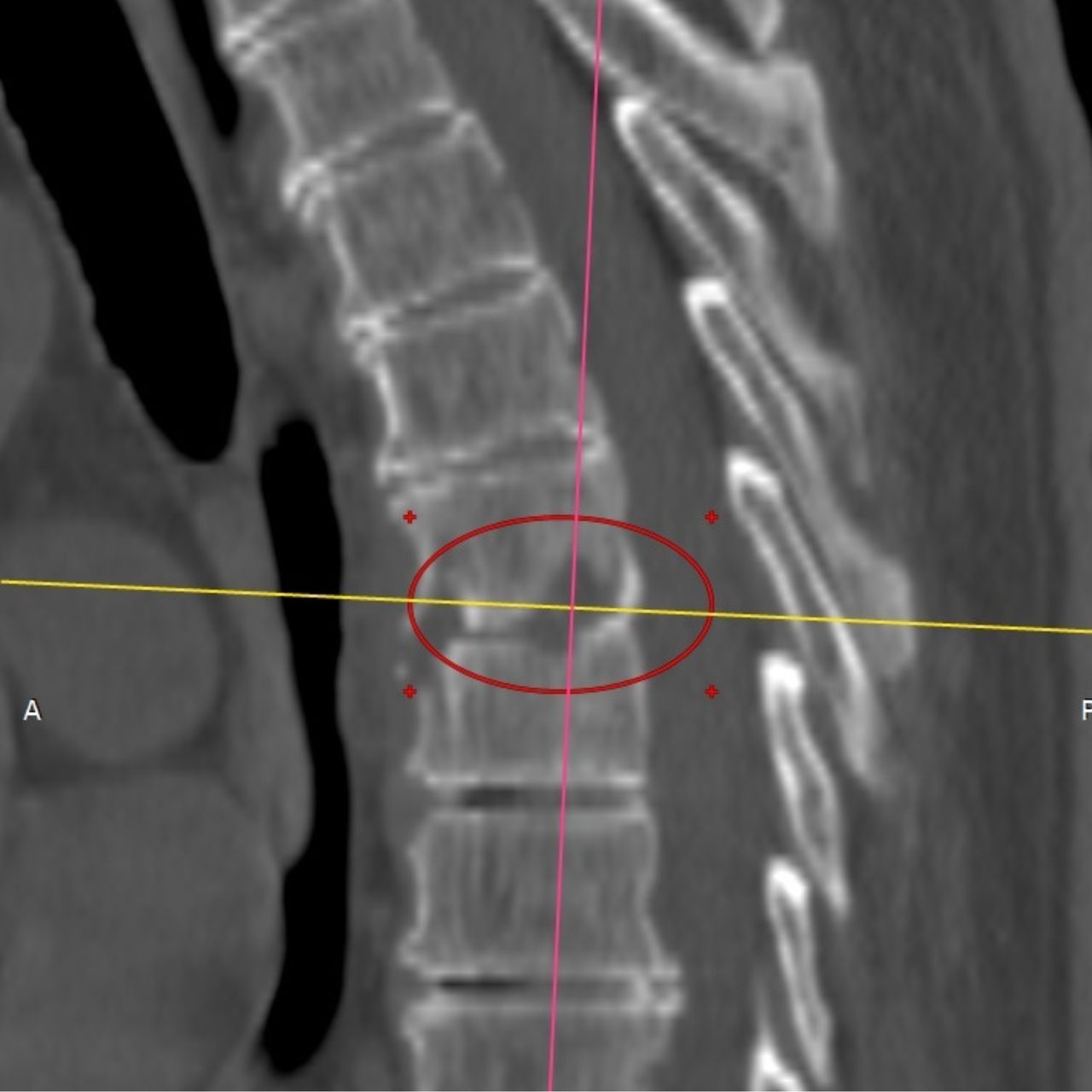 David Tafur Muñoz-1674