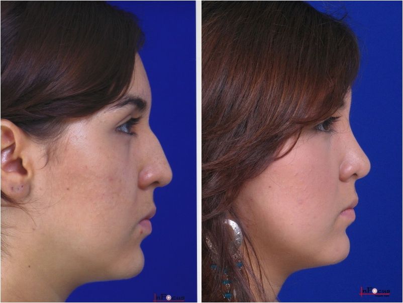 Jorge A Holguin Ruiz-25