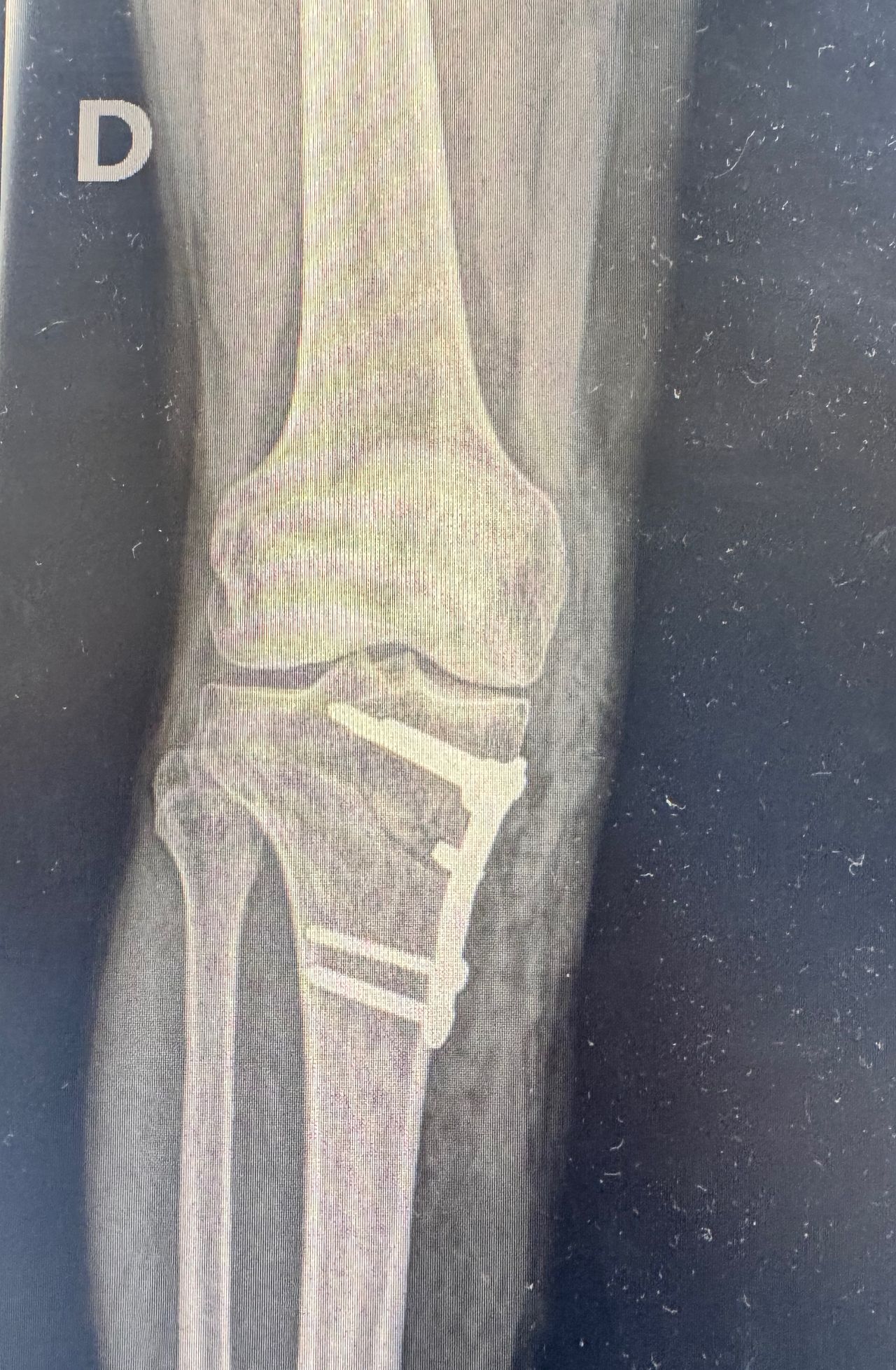 João Pedro Alves Ferreira-2