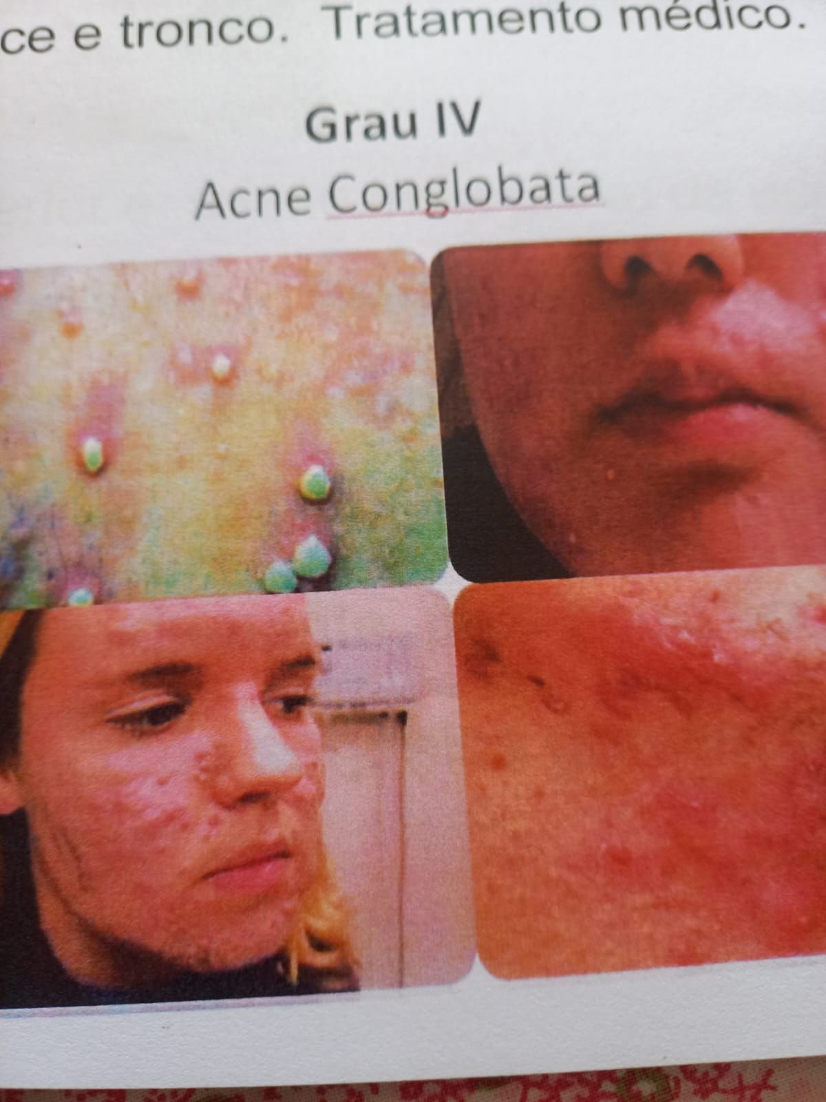 Iraci Maria De Souza-5