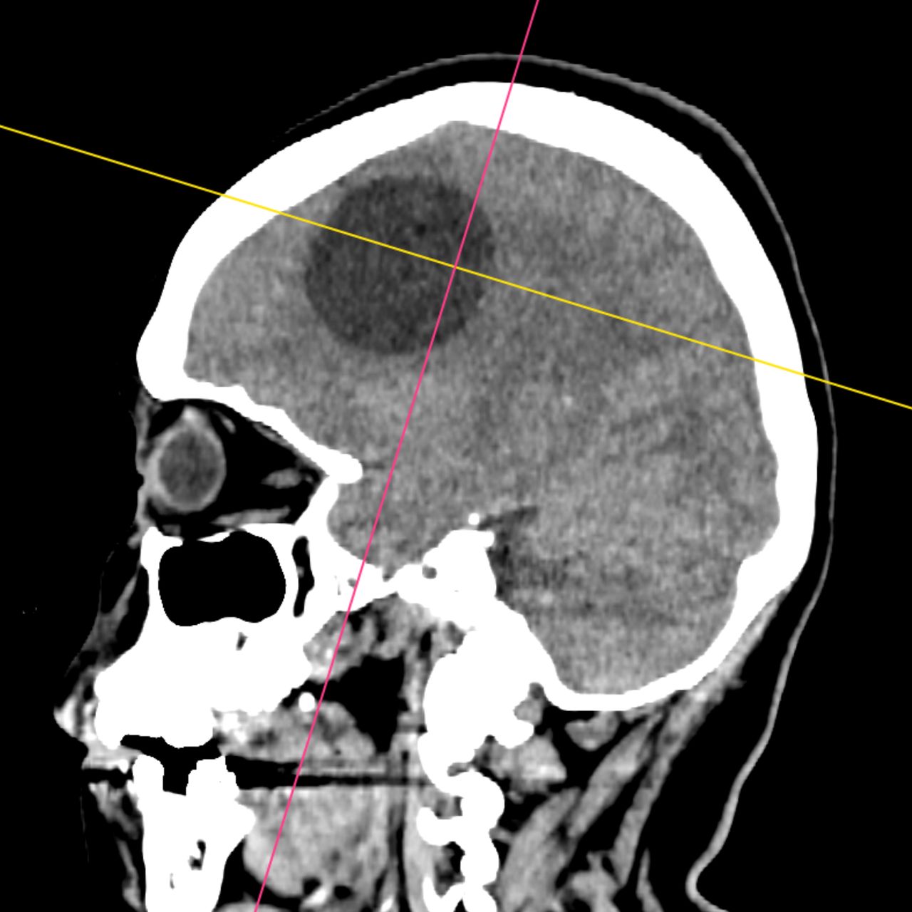 David Tafur Muñoz-1781