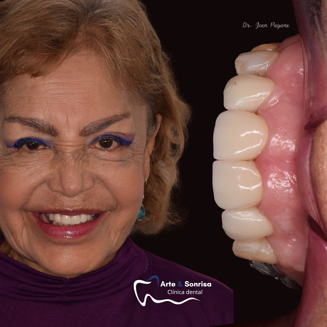 Jean Carlos Payano Arcos-4