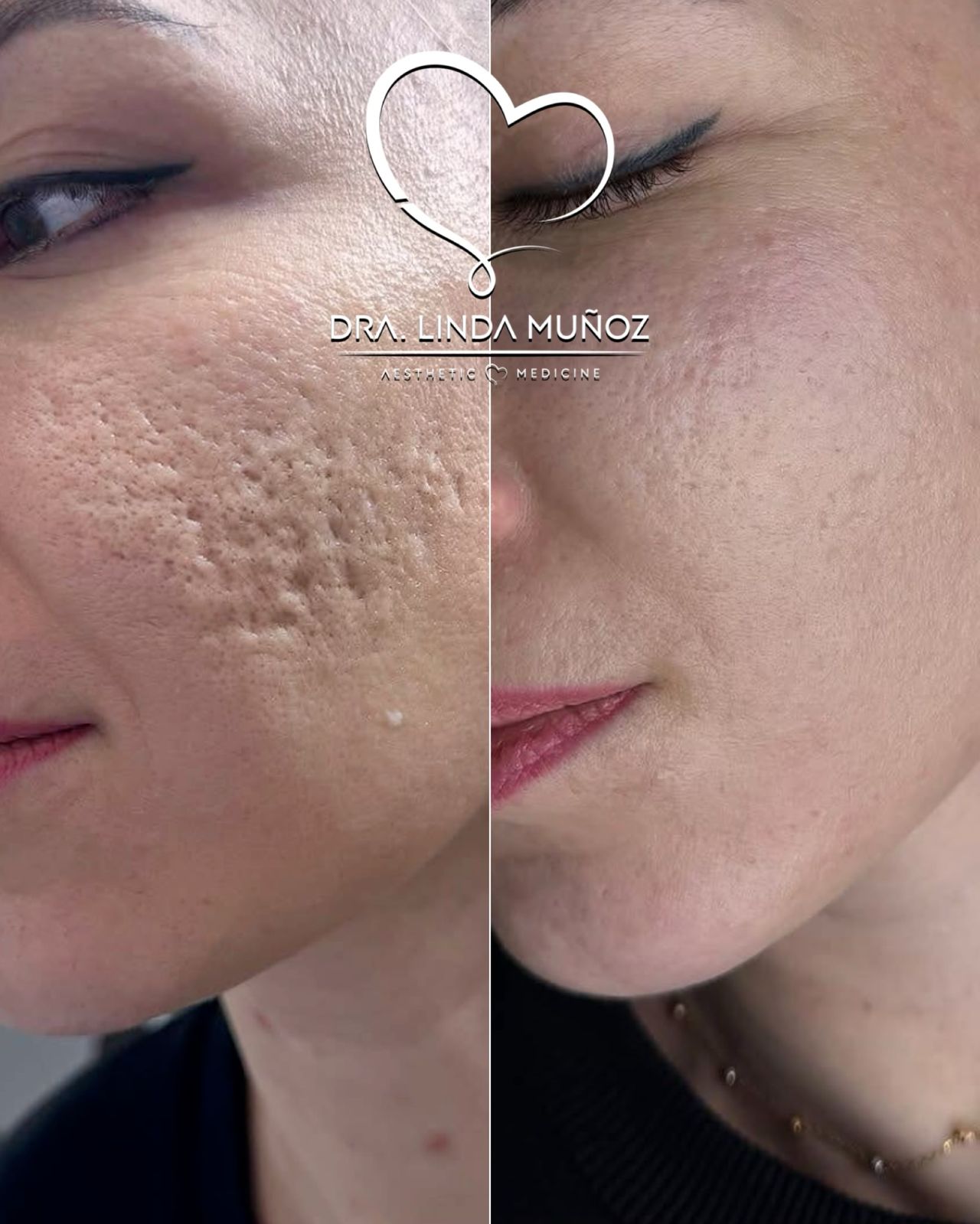 Linda Muñoz-30