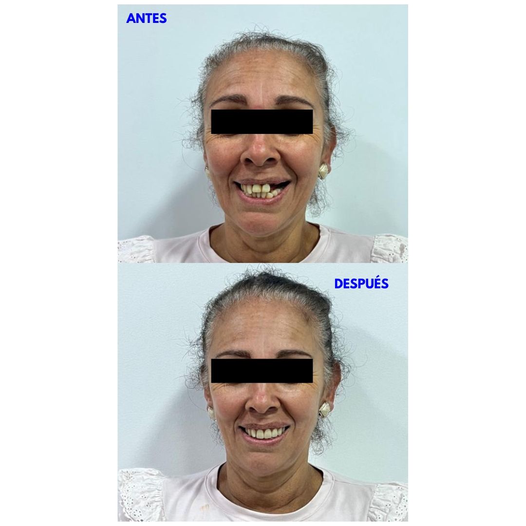 Carlos Andrés Giraldo Muñetón-3