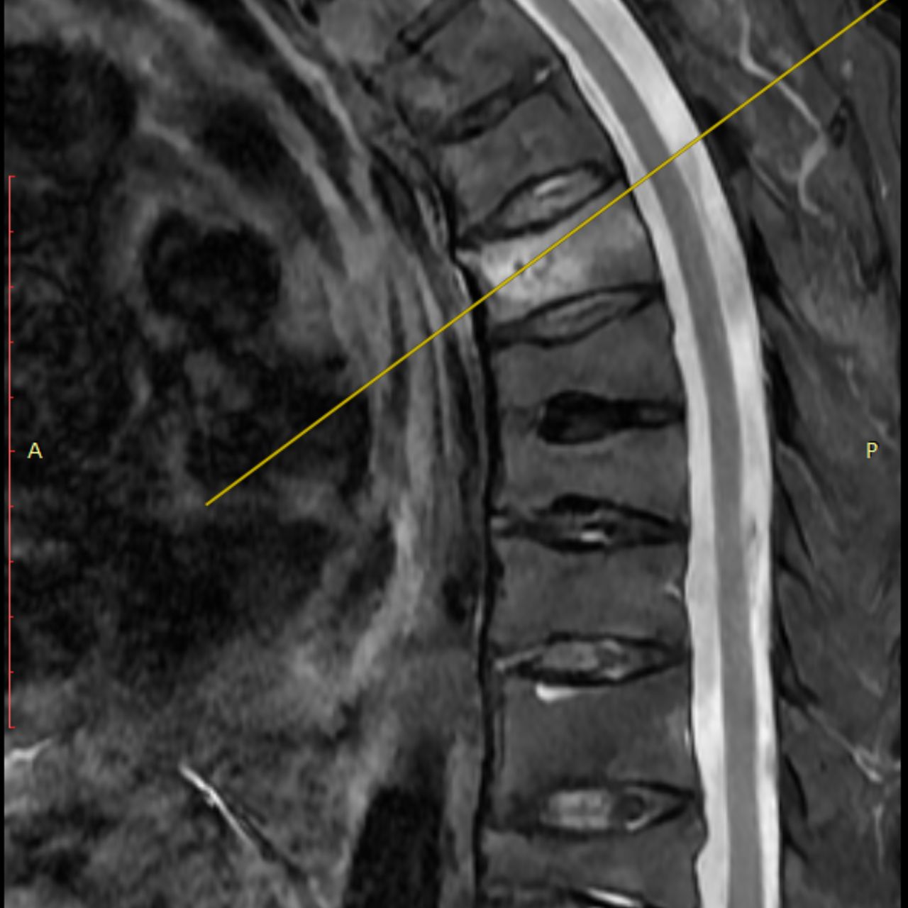David Tafur Muñoz-1459