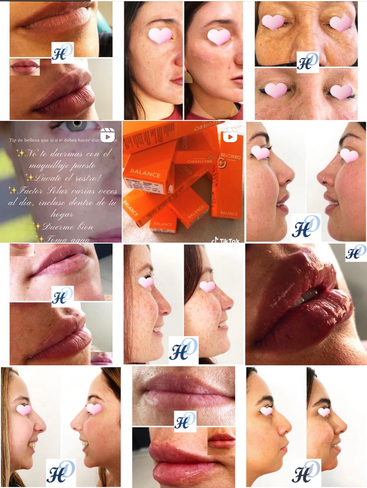 Daniela Hoffmeister-7