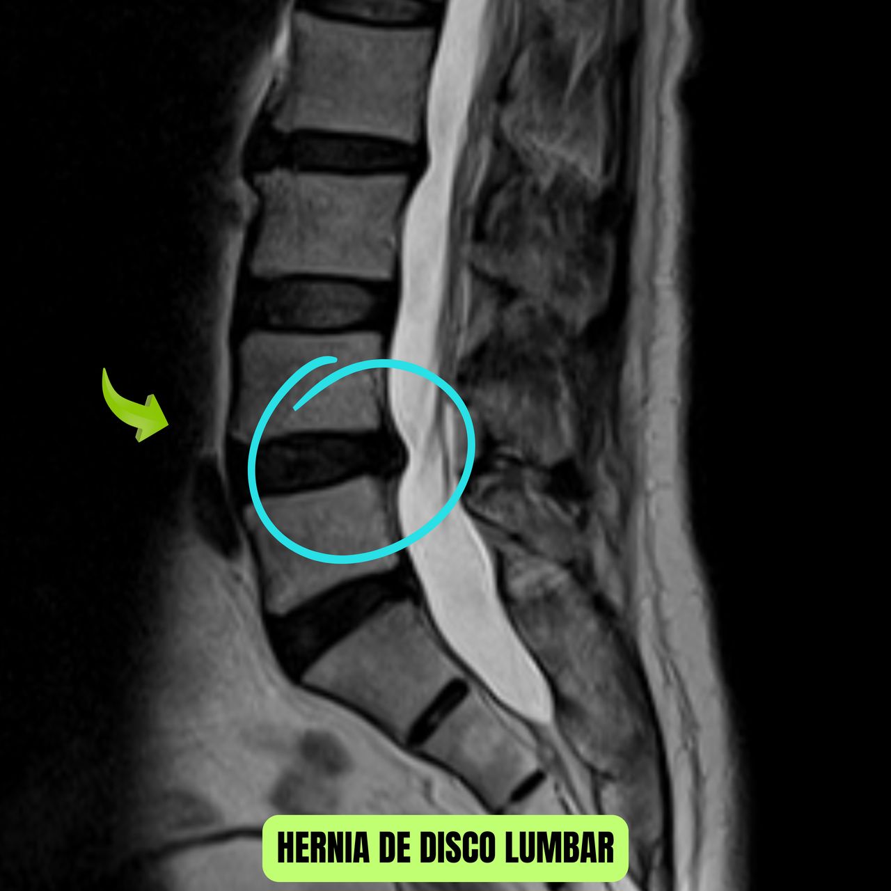 David Tafur Muñoz-2013