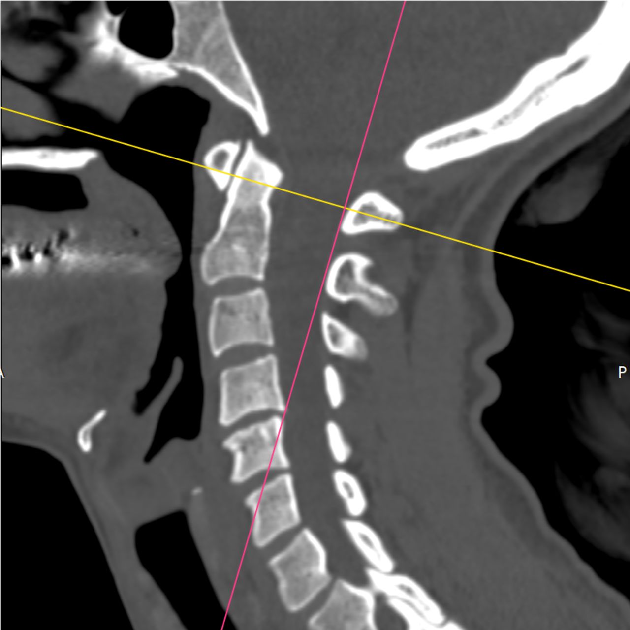 David Tafur Muñoz-1926