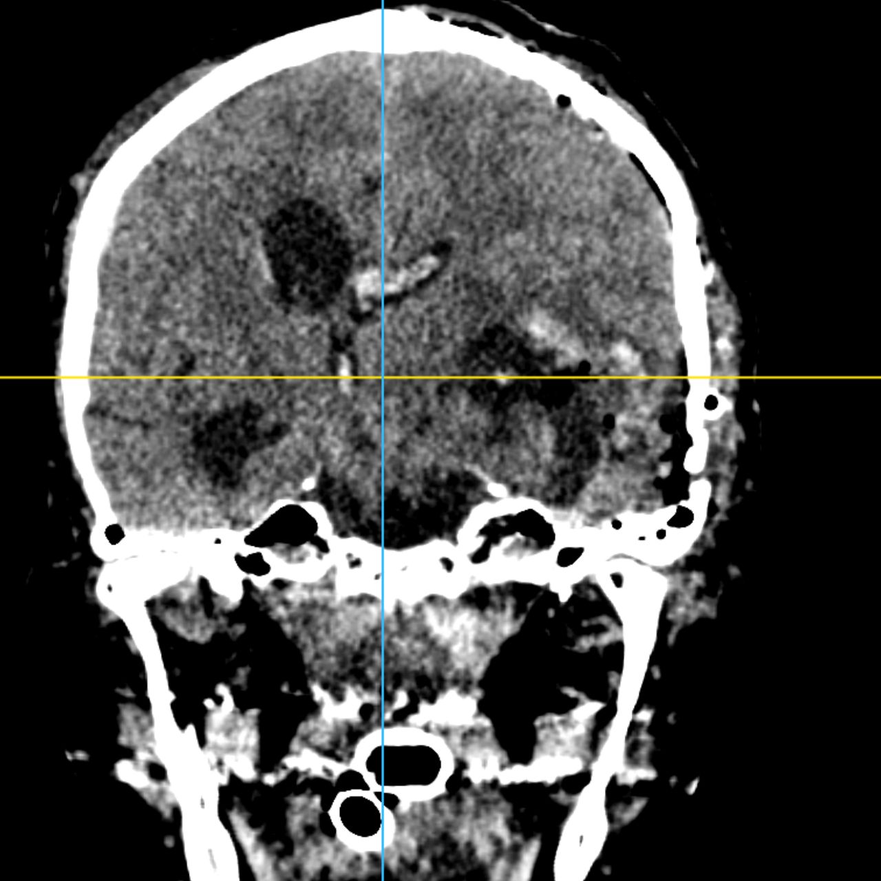 David Tafur Muñoz-1604