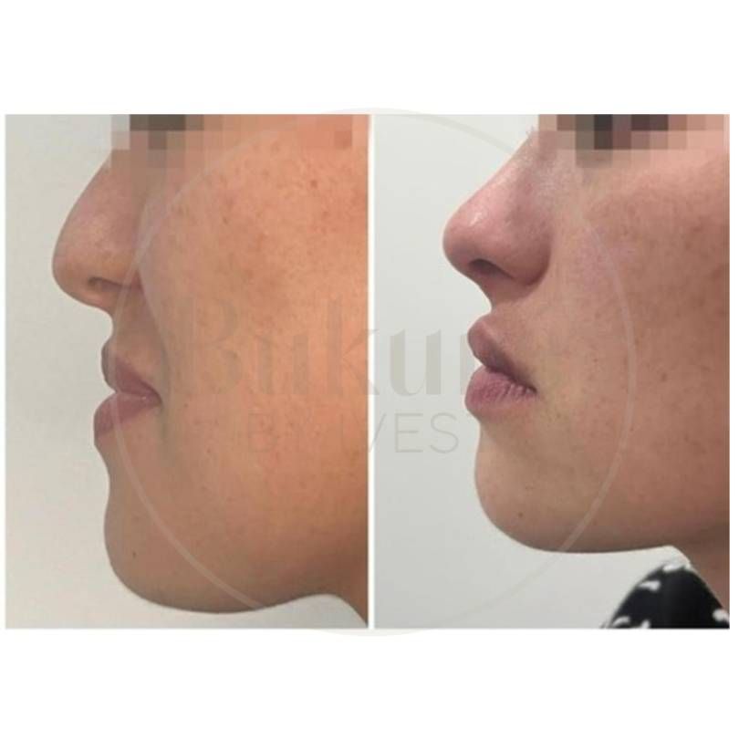 Oscar Iván Lozano Navarrete-25