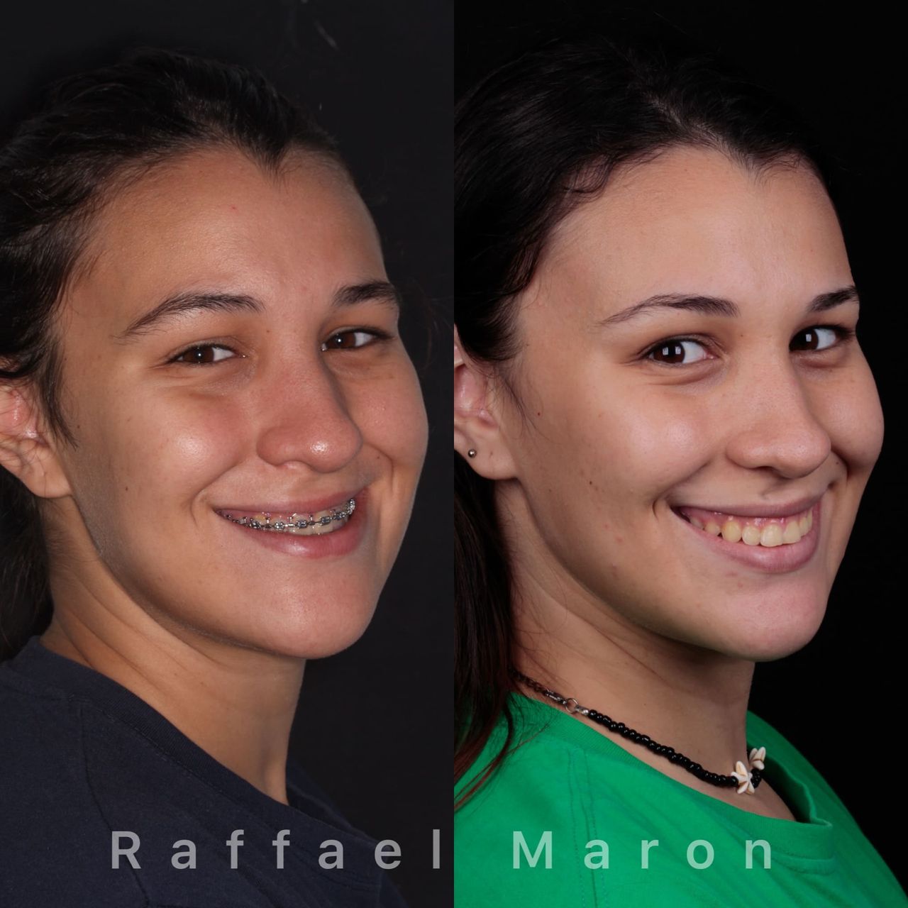 Raffael Maron Vieira De Noronha-12