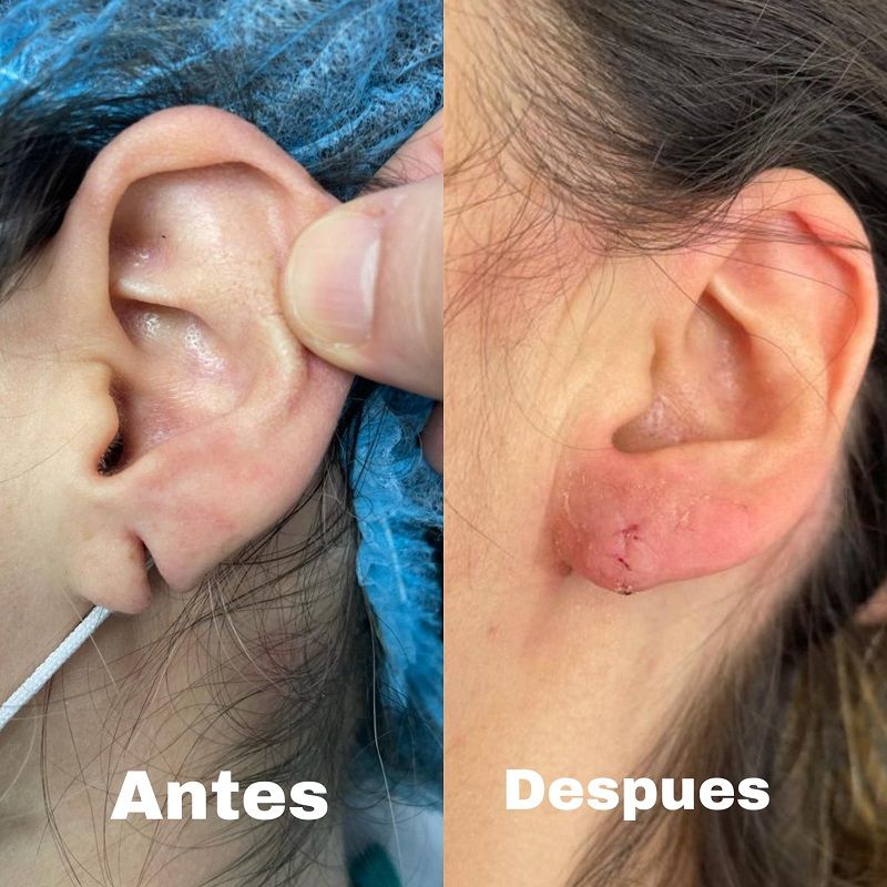 Ana Lucia Rave Martinez-7