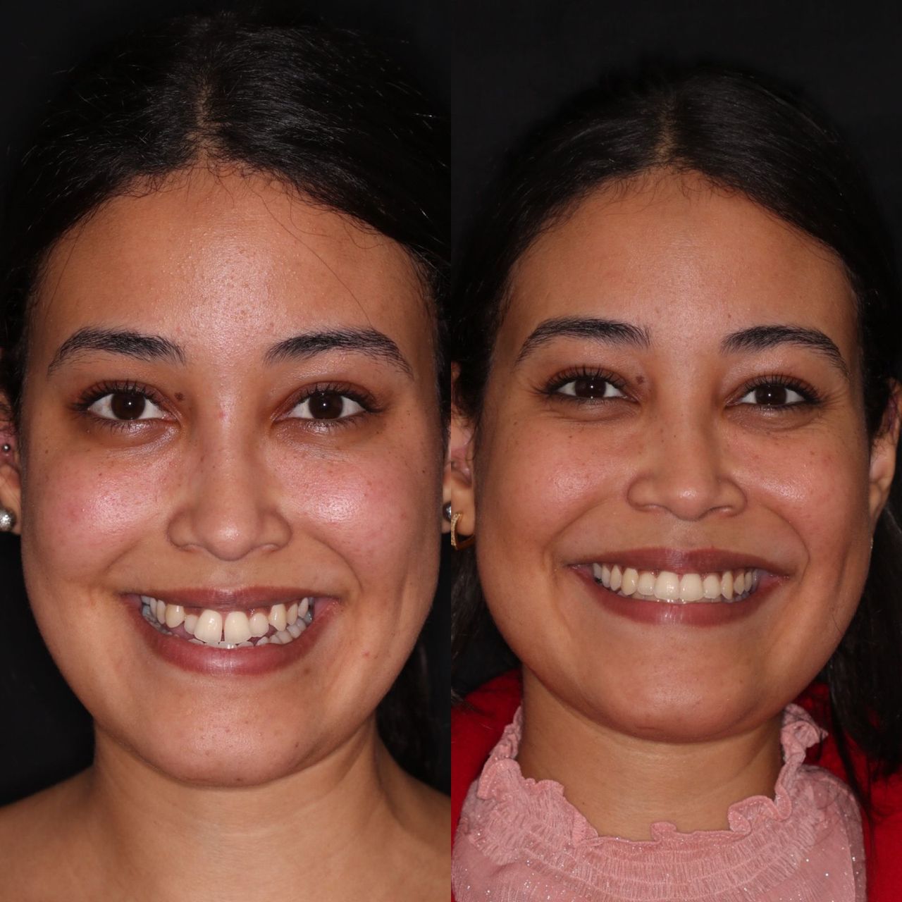 Bruno Nifossi Prado-15