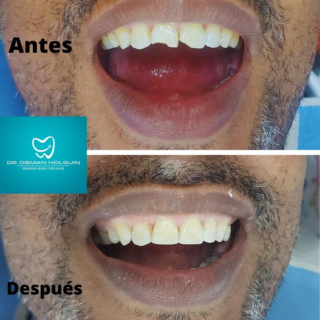 Osman Fernando Holguin Grisales-12