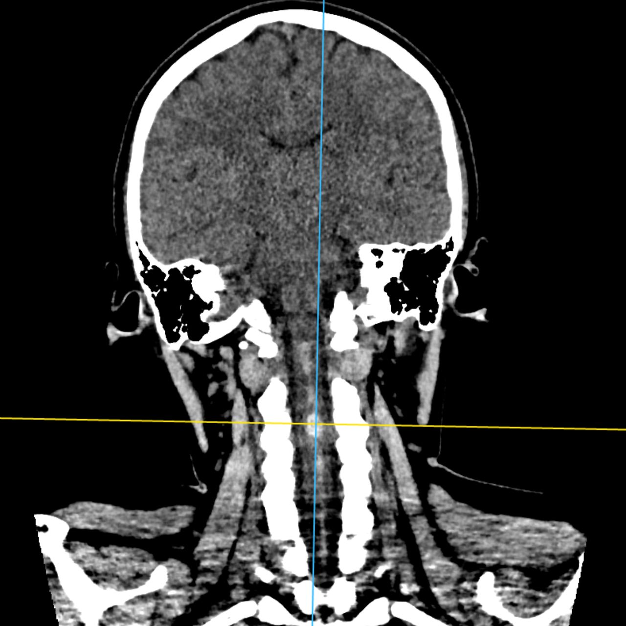 David Tafur Muñoz-1645