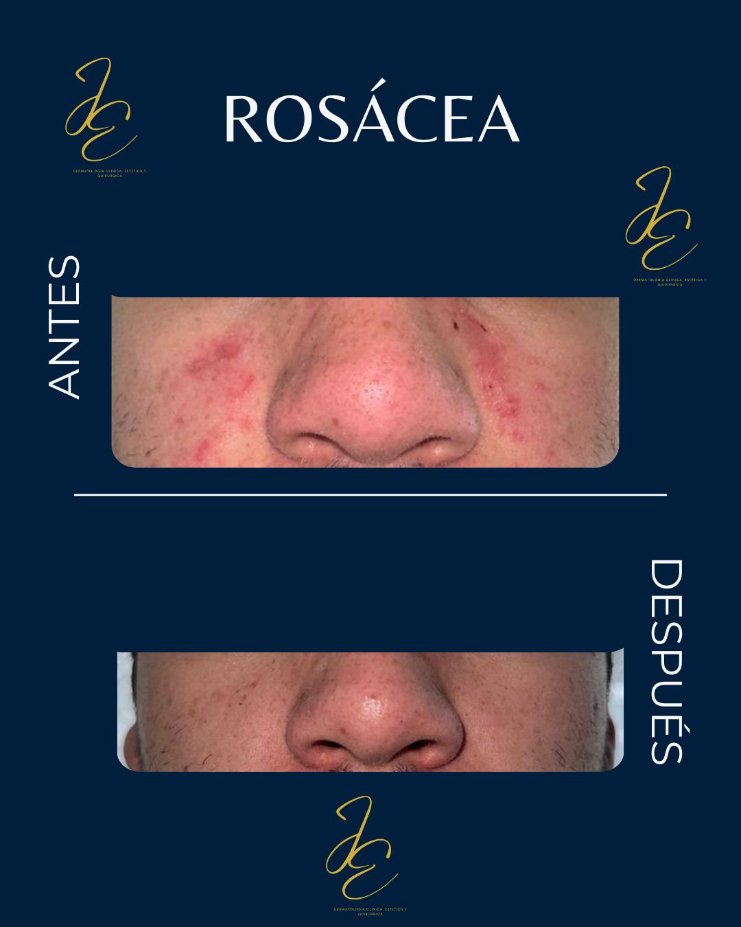 Jeanny Epieyu Diaz-13