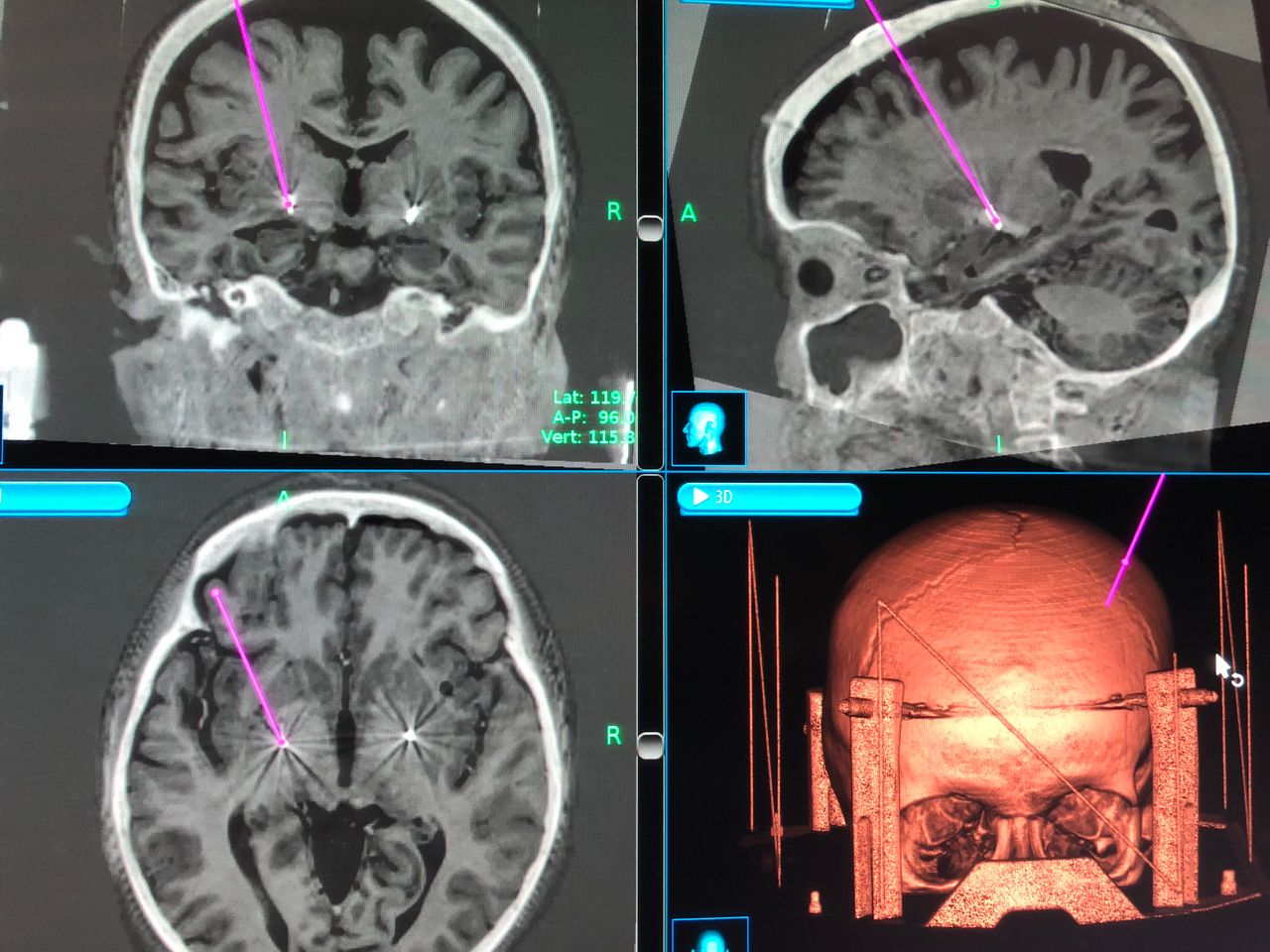 Juan Carlos Benedetti Isaac-8