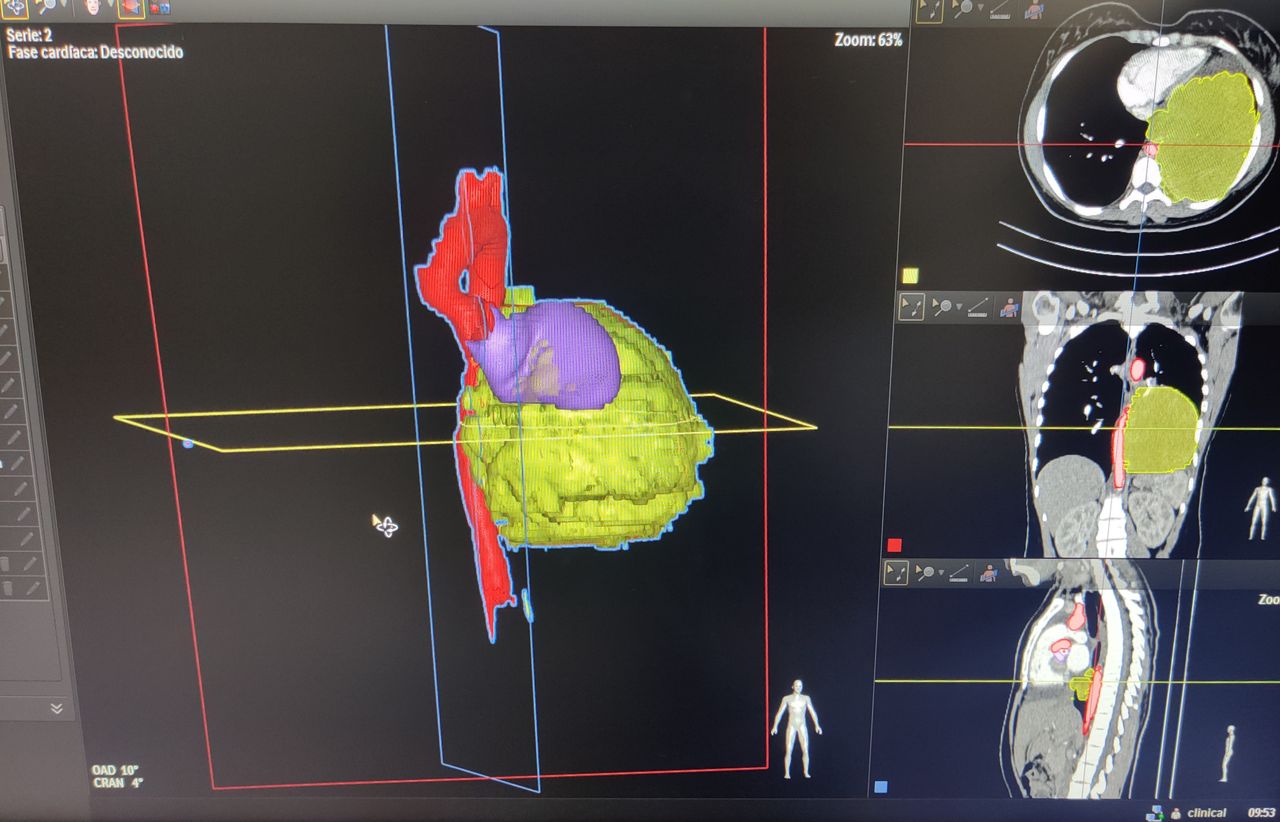 Willfredy Castaño Ruiz-18
