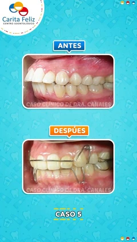 Angela Canales Larrea-6