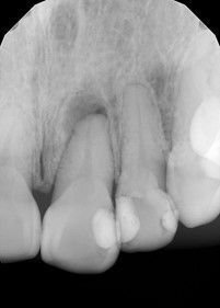 Hernán Andrés Febre Moscoso-13