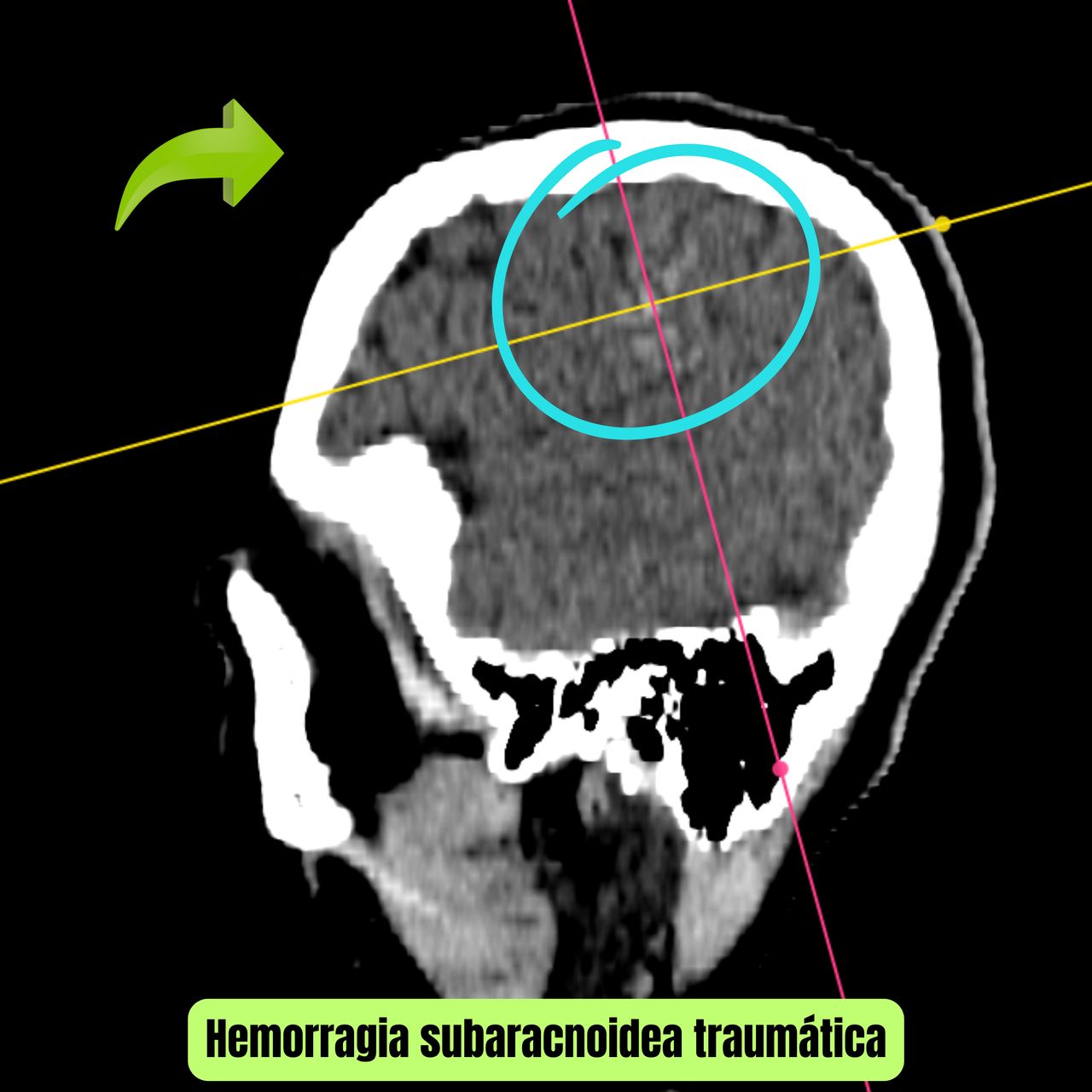 David Tafur Muñoz-2123