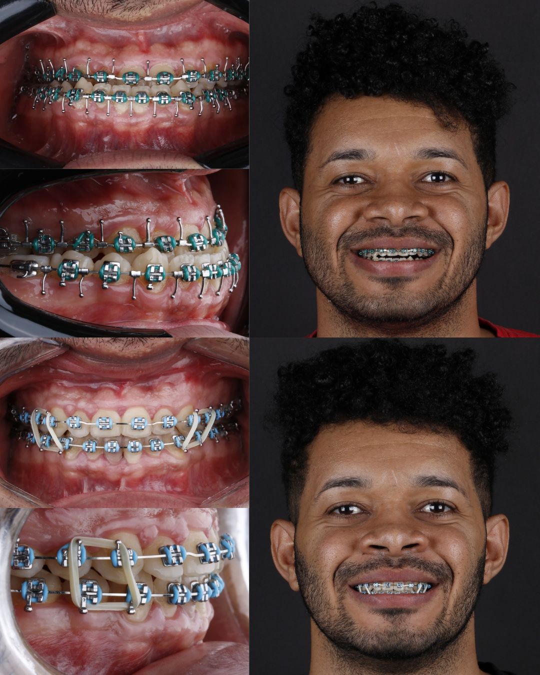 Roberto Soares Da Silva Júnior-7