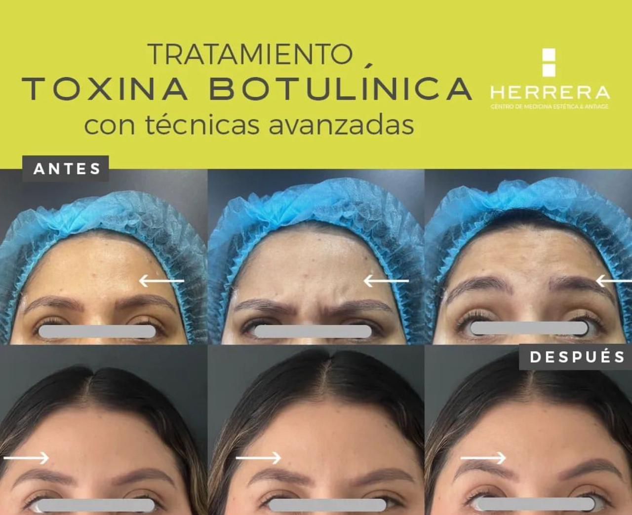 Andrea Alonso Herrera-11