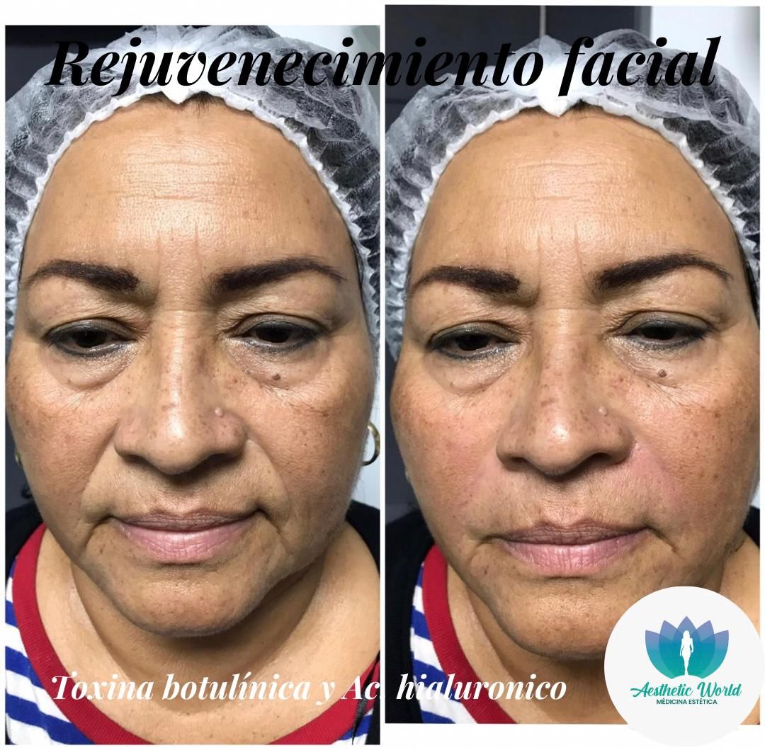 Jhonatan Oyola Farfán-13