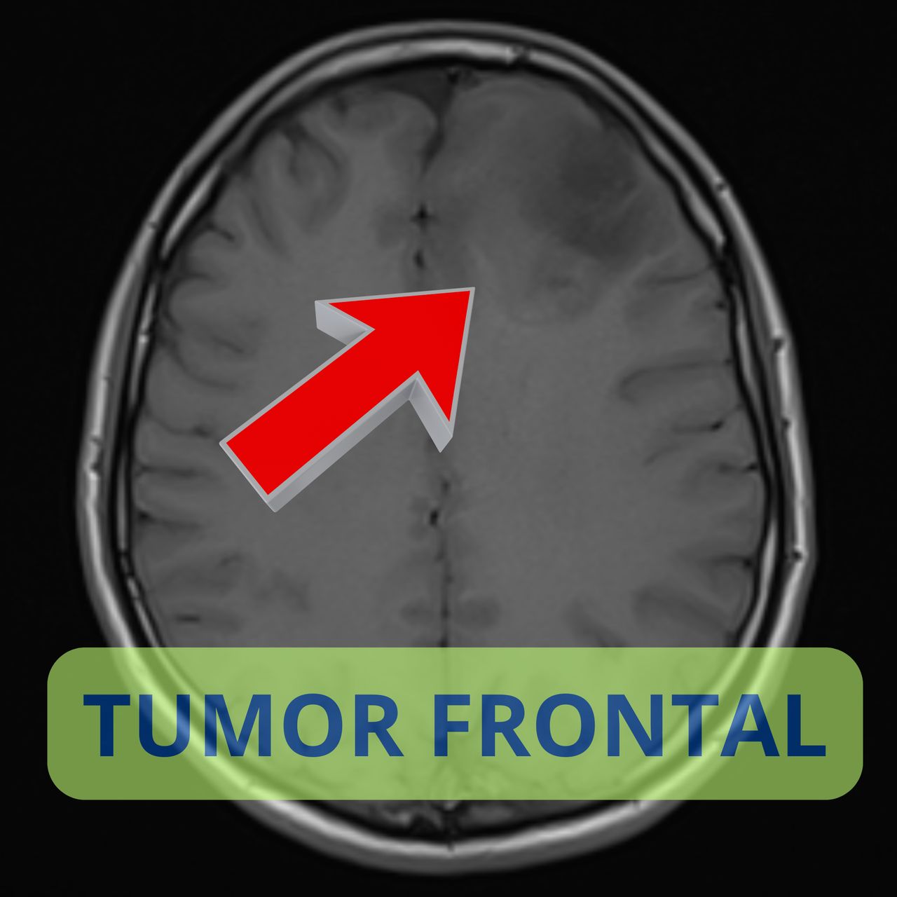 David Tafur Muñoz-2256